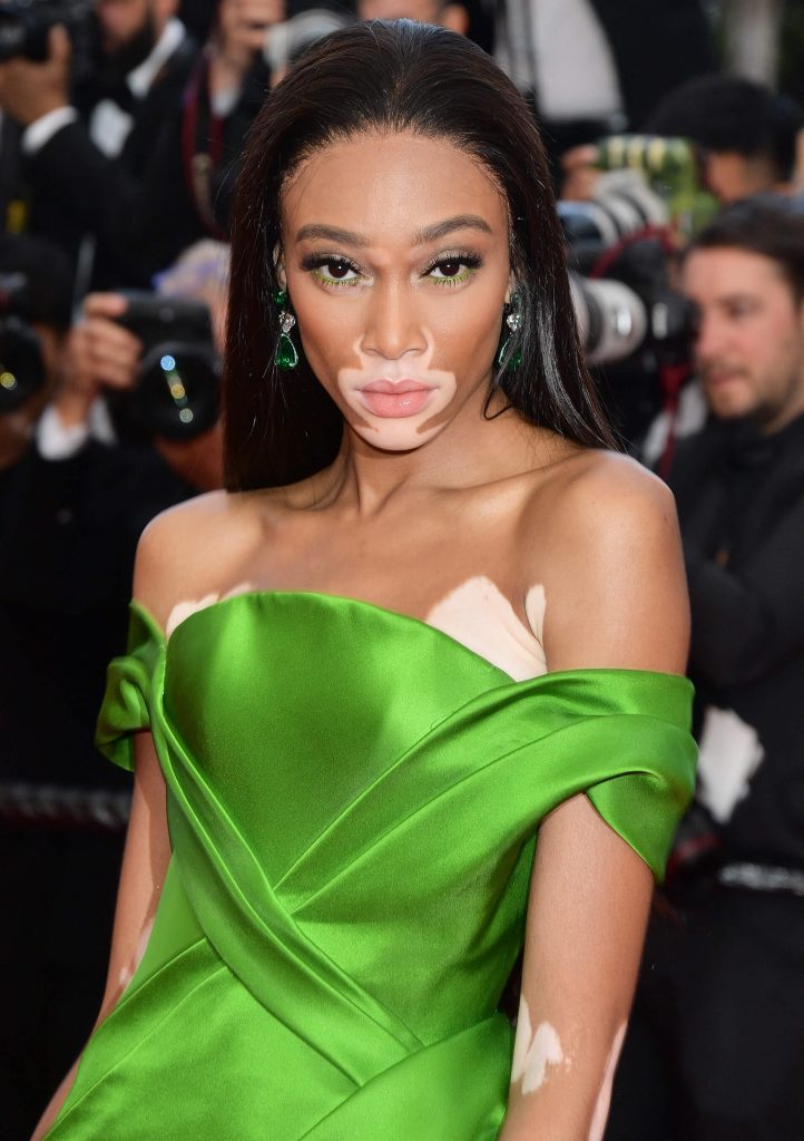 The Hottest Winnie Harlow Photos Around The Net - 12thBlog